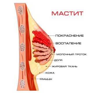 Боль у женщин