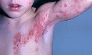 Другие патологии