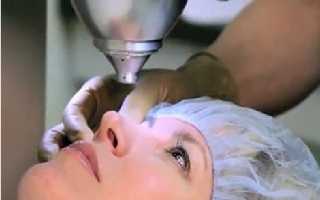 Какие объективы ставятся по ОМС