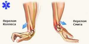 Классификация