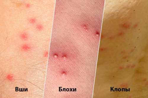 Места обитания