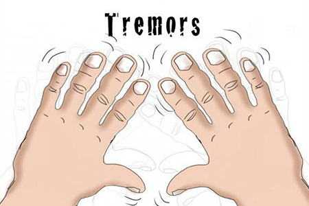 Причины и механизм развития