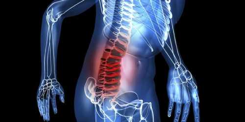 Виды компрессионных переломов
