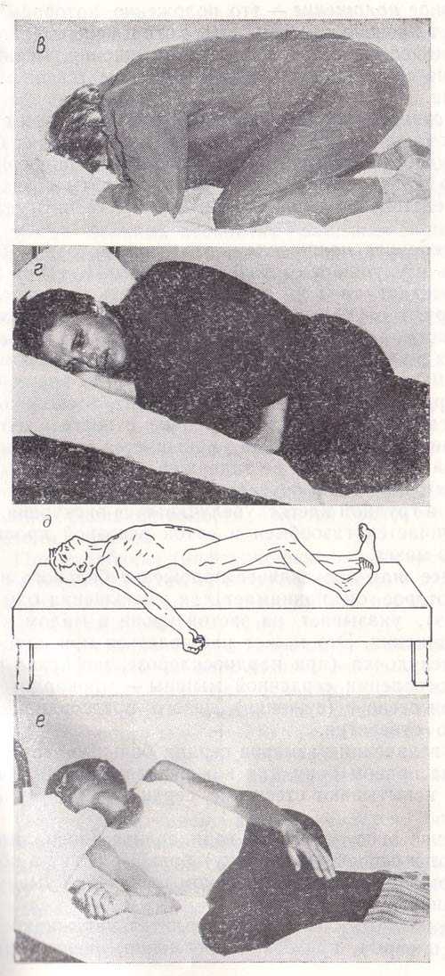 Вынужденное положение пациента при приступе бронхиальной астмы