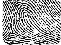 Вынужденное положение пациента при приступе бронхиальной астмы